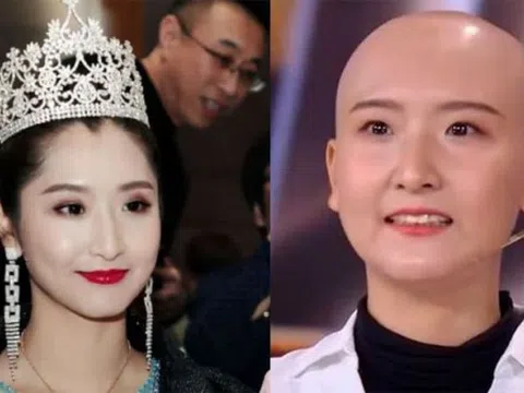 Hoa hậu Du lịch Trung Quốc Tô Nhật Mạn qua đời ở tuổi 29